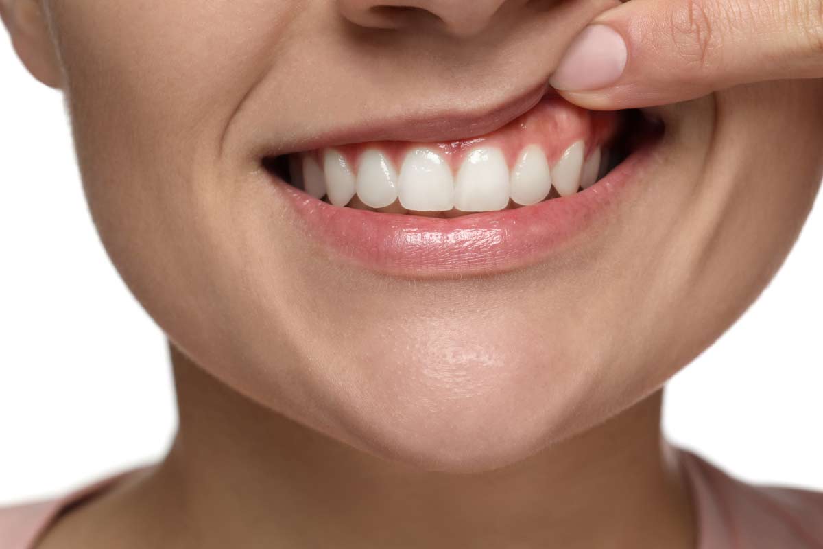 closeup of a patient's smile after visiting Twin Falls dental office Pocock Family Dental